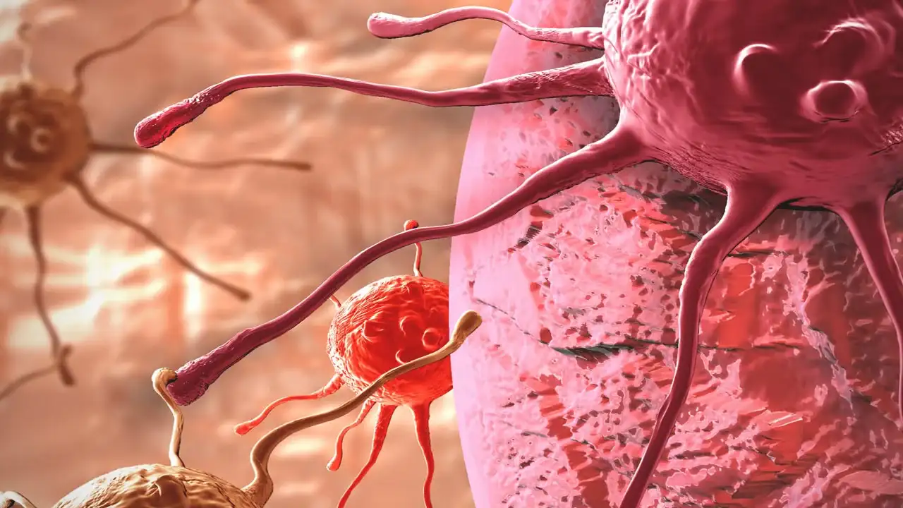 ///****علائم سرطان را جدی بگیرید ///****علائم سرطان را جدی بگیرید